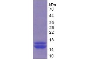 SDS-PAGE (SDS) image for Furin (Paired Basic Amino Acid Cleaving Enzyme) (FURIN) ELISA Kit (ABIN6574306)