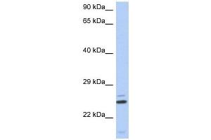 TTC9C antibody used at 1 ug/ml to detect target protein. (TTC9C antibody  (N-Term))