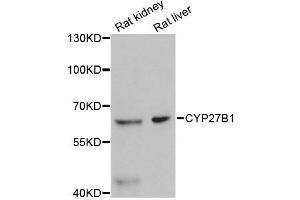 Western blot analysis of extracts of various cell lines, using CYP27B1 antibody (ABIN4903424) at 1:3000 dilution. (CYP27B1 antibody)