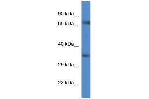 WB Suggested Anti-Slc6a9 AntibodyTitration: 1.