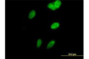 Immunofluorescence of purified MaxPab antibody to SORBS3 on HeLa cell. (Vinexin antibody  (AA 1-329))