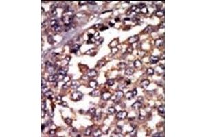 Immunohistochemistry (Paraffin-embedded Sections) (IHC (p)) image for anti-Protein Kinase A, alpha (PRKACA) (AA 1-30), (N-Term), (Regulatory Subunit 1) antibody (ABIN392680)