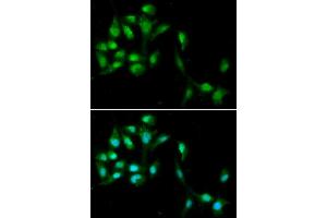 Immunofluorescence analysis of A549 cells using HEXIM1 antibody (ABIN5973397). (HEXIM1 antibody)