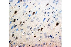 Anti-Neurotrophin 3 antibody, IHC(P) IHC(P): Rat Brain Tissue (Neurotrophin 3 antibody  (Middle Region))