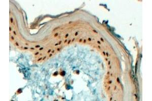 ABIN185355 (4µg/ml) staining of paraffin embedded Human Skin.