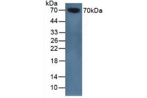 Detection of SERPINA10 in Mouse Serum using Polyclonal Antibody to Serpin A10 (SERPINA10) (SERPINA10 antibody  (AA 22-448))