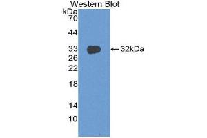 Western Blotting (WB) image for anti-DNA Fragmentation Factor, 45kDa, alpha Polypeptide (DFFA) (AA 51-305) antibody (ABIN2119453)