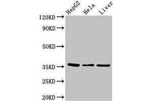 Western Blot Positive WB detected in: HepG2 whole cell lysate, Hela whole cell lysate, Mouse liver tissue All lanes: SPRY1 antibody at 2. (SPRY1 antibody  (AA 1-178))