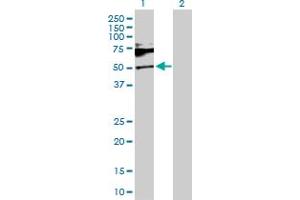 Western Blot analysis of SH2B1 expression in transfected 293T cell line by SH2B1 MaxPab polyclonal antibody.