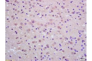 Formalin-fixed and paraffin embedded rat brain labeled with Anti-Neprilysin 2 Polyclonal Antibody, Unconjugated (ABIN1386041) at 1:200 followed by conjugation to the secondary antibody and DAB staining