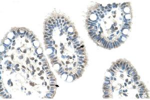 Immunohistochemistry (IHC) image for anti-Nuclear Receptor Subfamily 0, Group B, Member 1 (NR0B1) (N-Term) antibody (ABIN2782265)