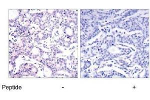 Image no. 1 for anti-Nuclear Factor of kappa Light Polypeptide Gene Enhancer in B-Cells 1 (NFKB1) (Ser893) antibody (ABIN197124)