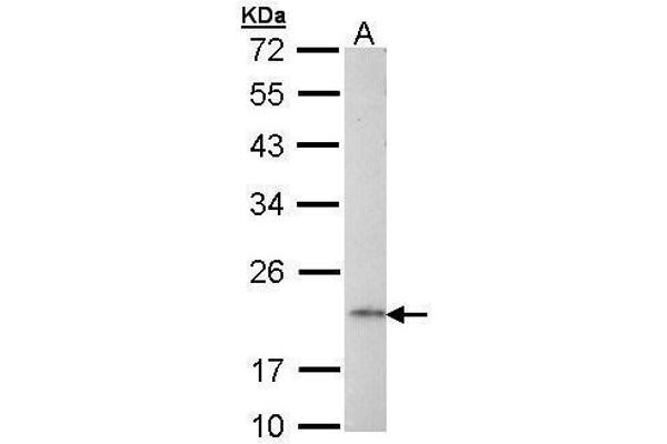 AP1S2 antibody  (full length)