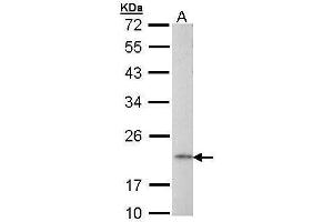 WB Image Sample (30 ug of whole cell lysate) A: Raji 12% SDS PAGE antibody diluted at 1:1000 (AP1S2 antibody  (full length))