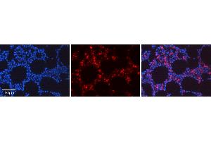 Rabbit Anti-REL Antibody Catalog Number: ARP36966_P050 Formalin Fixed Paraffin Embedded Tissue: Human Bone Marrow Tissue Observed Staining: Nucleus, Cytoplasm Primary Antibody Concentration: 1:100 Other Working Concentrations: 1:600 Secondary Antibody: Donkey anti-Rabbit-Cy3 Secondary Antibody Concentration: 1:200 Magnification: 20X Exposure Time: 0. (c-Rel antibody  (Middle Region))