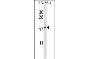 Western blot analysis in ZR-75-1 cell line lysates (35ug/lane). (TNP2 antibody  (C-Term))