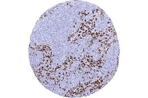 Strong factor XIII immunostaining of sinus histiocytes in a lymph node (F13A1 antibody  (AA 46-181))