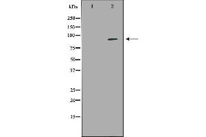 Western blot analysis of Hela whole cell lysates, using NEDD9 Antibody. (NEDD9 antibody  (Internal Region))