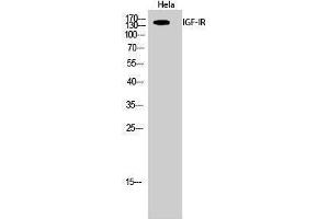 Western Blotting (WB) image for anti-Insulin-Like Growth Factor 1 Receptor (IGF1R) (Ser1026) antibody (ABIN3185133) (IGF1R antibody  (Ser1026))