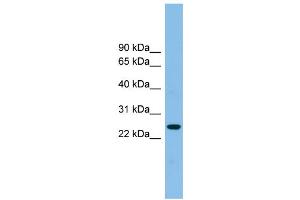 WB Suggested Anti-TSPAN4 Antibody Titration: 0. (TSPAN4 antibody  (Middle Region))
