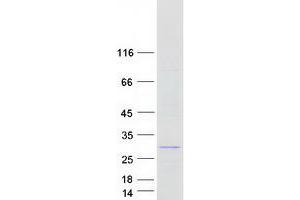 Breast Carcinoma Amplified Sequence 4 (BCAS4) (Transcript Variant 2) protein (Myc-DYKDDDDK Tag)