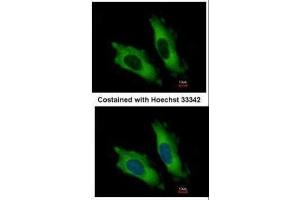 ICC/IF Image Immunofluorescence analysis of methanol-fixed HeLa, using EIF4A2, antibody at 1:500 dilution. (EIF4A2 antibody)