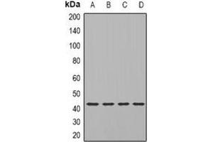 Western blot analysis of TIA1 expression in SKOV3 (A), Hela (B), mouse brain (C), rat brain (D) whole cell lysates. (TIA1 antibody)