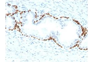 Immunohistochemistry (IHC) image for anti-Tumor Protein P63 (TP63) antibody (ABIN6940967)