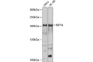 Western blot analysis of extracts of various cell lines, using KIF14 antibody (ABIN6129691, ABIN6142854, ABIN6142855 and ABIN6214465) at 1:1000 dilution. (KIF14 antibody  (AA 1399-1648))