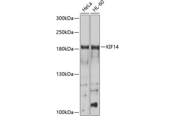 KIF14 anticorps  (AA 1399-1648)