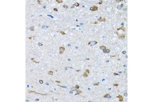 Immunohistochemistry of paraffin-embedded mouse spinal cord using RARS antibody (ABIN5973728) at dilution of 1/100 (40x lens). (RARS antibody)