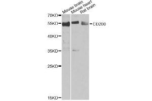Western blot analysis of extracts of various cell lines, using CD200 antibody (ABIN2561685) at 1:1000 dilution. (CD200 antibody)