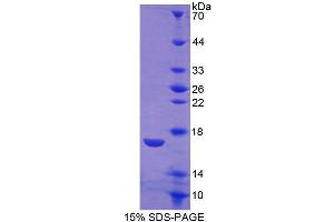 SDS-PAGE (SDS) image for Calcitonin Receptor (CALCR) (AA 34-148) protein (His tag) (ABIN6238973) (Calcitonin Receptor Protein (CALCR) (AA 34-148) (His tag))