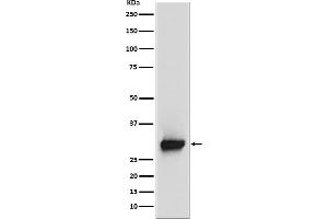 Western blot analysis of Calretinin expression in SH-SY5Y cell lysate.