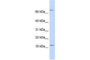 TRA16 antibody used at 1 ug/ml to detect target protein. (NR2C2AP antibody  (N-Term))