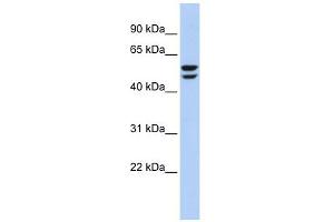 ATP6V1B2 antibody used at 1 ug/ml to detect target protein. (ATP6V1B2 antibody  (N-Term))