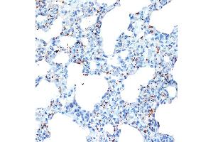 Immunohistochemistry of paraffin-embedded rat lung using CXCL4/CXCL4/PF4 Rabbit mAb (ABIN1683188, ABIN3017983, ABIN3017984 and ABIN7101555) at dilution of 1:100 (40x lens). (PF4 antibody)