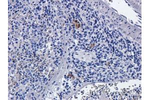 Immunohistochemistry (IHC) image for anti-IL2RA (Basiliximab Biosimilar) antibody (ABIN5668050)