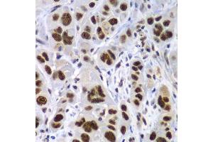 Immunohistochemistry (Paraffin-embedded Sections) (IHC (p)) image for anti-Splicing Factor 3b, Subunit 2, 145kDa (SF3B2) (AA 616-895) antibody (ABIN6147666)