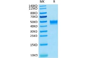 Human FGFR3 beta (IIIb) on Tris-Bis PAGE under reduced condition.