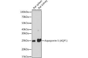 Western blot analysis of extracts of various cell lines, using Aquaporin-1 (Aquaporin-1 ) Rabbit mAb (ABIN1682901, ABIN3018679, ABIN3018680 and ABIN7101646) at 1:1000 dilution. (Aquaporin 1 antibody)