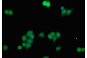 Immunofluorescent analysis of PC-3 cells using ABIN7144300 at dilution of 1:100 and Alexa Fluor 488-congugated AffiniPure Goat Anti-Rabbit IgG(H+L) (ANO1 antibody  (AA 1-151))