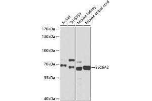 Western blot analysis of extracts of various cell lines, using SLC6 antibody (ABIN6130907, ABIN6148042, ABIN6148043 and ABIN6218497) at 1:1015 dilution. (SLC6A2 antibody  (AA 1-70))