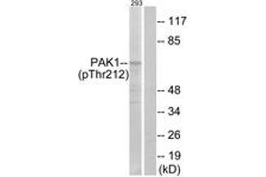 Western blot analysis of extracts from 293 cells treated with etoposide 25uM 1h, using PAK1 (Phospho-Thr212) Antibody.