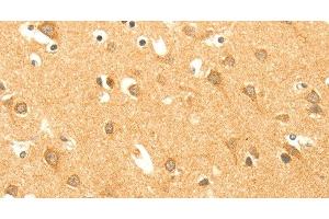 Immunohistochemistry of paraffin-embedded Human brain using AARS2 Polyclonal Antibody at dilution of 1:40 (AARS2 antibody)