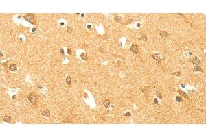 Immunohistochemistry of paraffin-embedded Human brain using AARS2 Polyclonal Antibody at dilution of 1:40 (AARS2 antibody)