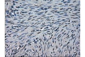 Image no. 1 for anti-Crystallin, alpha B (CRYAB) antibody (ABIN1497641) (CRYAB antibody)