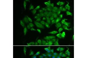 Immunofluorescence analysis of MCF-7 cells using RBP2 Polyclonal Antibody (RBP2 antibody)