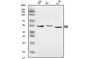 Western blot analysis of SSB using anti-SSB antibody (ABIN7602125).