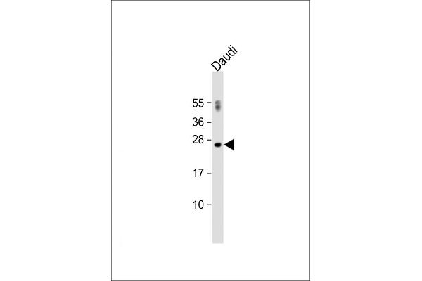 PTTG1 antibody  (N-Term)